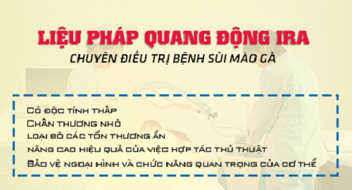 Chữa sùi mào gà bằng liệu pháp quang động IRA